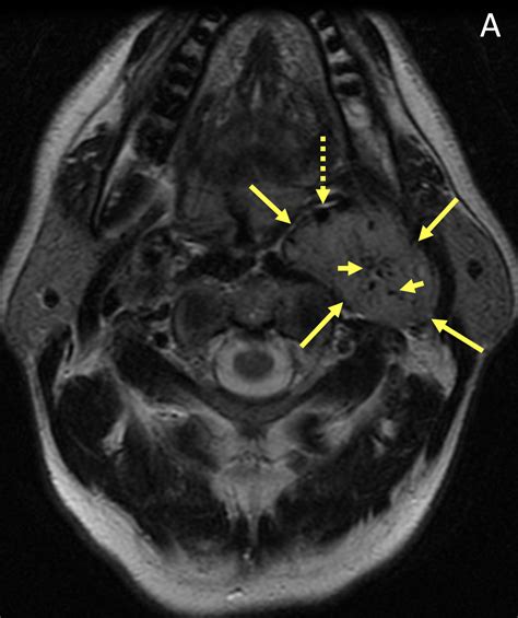 Mri online - We would like to show you a description here but the site won’t allow us. 